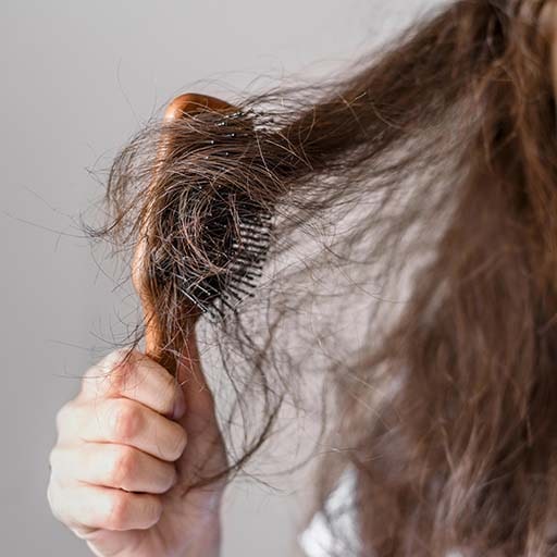 Kadın tipi Saç Dökülmesi